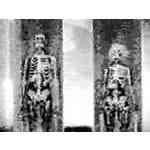 Picture for song 'The Letter' by artist 'The Tingler'