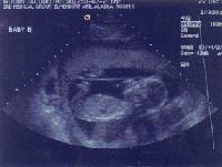 Picture for song '21-*BONUS* Island Boyz Off Da Chain' by artist 'Tip Of Da ICEBERG'