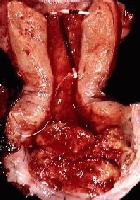 Picture for song 'Boxing' by artist 'Triumph (Prophet)'