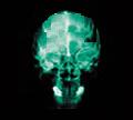 Picture for song 'Get Ya Brain Lit' by artist 'V I N C'