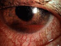 Picture for song 'Trauma' by artist 'V tas'