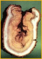 Picture for song 'Canker' by artist 'Wood'