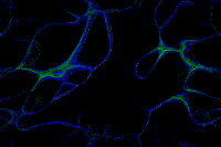 Picture for song 'Moment of darkness' by artist 'Wrinklicious'