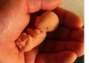 Picture for song 'CANIBAL FETUS' by artist 'Andy Smooth'