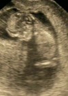 Picture for song 'spirit of my baby' by artist 'johnnyboyserbia'