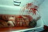 Picture for song 'effects of sdp' by artist 'StonedDeath productions'