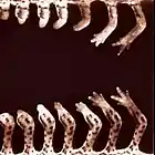 Picture for song 'Amputations' by artist 'Ozmoroid'