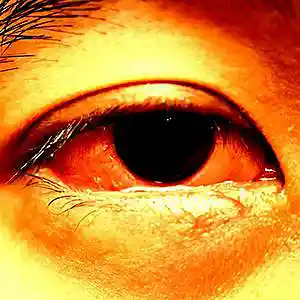 Picture for song 'Red Eyes' by artist 'donttellanyone'