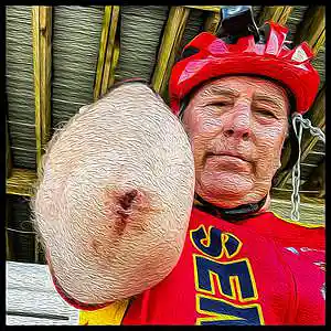 Picture for song 'BIKE CRASH (TRUE STORY)' by artist 'Johnny Fubar'