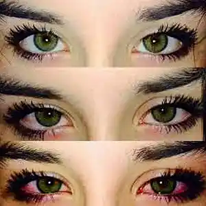 Picture for song 'M D M A (PRODIGY x CHE-BROTHERS x SKRILLEX x TYPE)' by artist 'LAKKY NINJA'