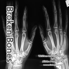 Picture for song 'Broken_Bones_Remake_Test' by artist 'Alisha Poor'