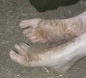 Picture for song '#102-Hairy Feet (1989)' by artist 'Rob Lincoln'