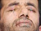 Picture for song 'Sew My Eyes Shut' by artist 'Str8jackit'