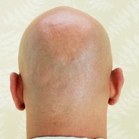 Picture for song 'Bald' by artist 'strictlyPresidential ENT'