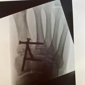 Picture for song 'Get Well' by artist 'Hardheaded'