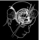 Picture for song 'Lobotomy' by artist 'Black Chamber'