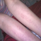 Picture for song 'Sorry I Can't Lite You Fire' by artist 'Charly'