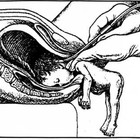 Picture for song 'You Should Of Been An Abortion' by artist 'Nick Caldwell And The Robot Drummer'