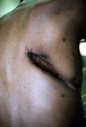Picture for song 'Intubbed Scar' by artist 'Orgazmatik con Karne'