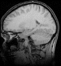 Picture for song 'BrainPowder' by artist 'Digitally Natured Audio'