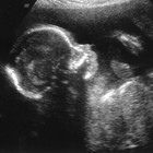 Picture for song 'Blood Work (Free Download)' by artist 'KayotikKraftz'