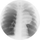 Picture for song 'Lung' by artist 'Fingerprint Chaos'