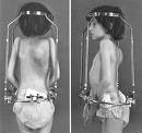 Picture for song 'Brain Surgery' by artist 'Noise Nurse'