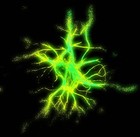 Picture for song 'Infection.mp3' by artist 'Paramedic Dubs'