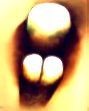 Picture for song 'Hurt' by artist 'SPiNETRiP'