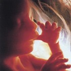 Picture for song 'Life Begins' by artist 'Squeez'