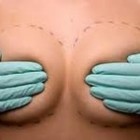 Picture for song 'Saline Boobies' by artist 'Rick Cormier'