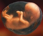 Picture for song 'Baby Fetus -==NEW!!==-' by artist 'TDR's Beatz'