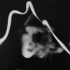 Picture for song 'Sunbreak' by artist 'Dr. Cascade and The Abyss'