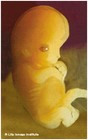 Picture for song 'Unborn Life' by artist 'KnOwGoOd KnOwGoD'
