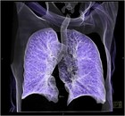 Picture for song 'Heal Me' by artist 'An Infinite Number of Chimps'