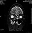 Picture for song 'Shadow & Ayreon The Don - Criminal Minded' by artist 'Blue Squall'