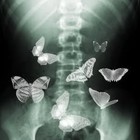 Picture for song 'Butterflies' by artist 'MiG L Beatz'