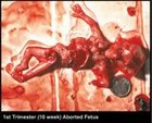 Picture for song 'Dreams of Sick Death ft Lord Fetus' by artist 'RAK'