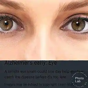 Picture for song 'blind sight' by artist 'Oson'