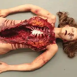 Picture for song 'Autopsy' by artist 'Thomas von Zig'
