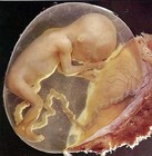 Picture for song '0rchestra: Sym2 mv1 'In the Womb'' by artist 'KE Peace (USA)'