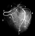 Picture for song 'We Like to Call That a Rash' by artist 'l'Oiseaux'