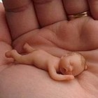 Picture for song 'There's Still Nothing Funny About Kids with Cancer' by artist 'The Pubes'