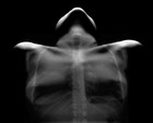 Picture for song 'I can't move' by artist 'DJ Harrewarre'