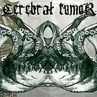 Picture for song 'Cerebral tumor' by artist 'Cerebral tumor'