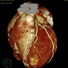 Picture for song 'TrinexX, DKP & cryZAL - Herzrhythmusstoerung' by artist 'affenboy'