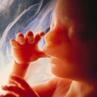 Picture for song 'fetus' by artist 'Mad Plaid'