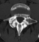 Picture for song 'Dead Left Leg Blues.mp3' by artist 'Open Heart Trouble'