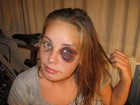 Picture for song 'Black Eye pt.1' by artist 'Steve Crispen'