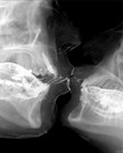 Picture for song 'Asthma Kisses' by artist 'Abacinate'